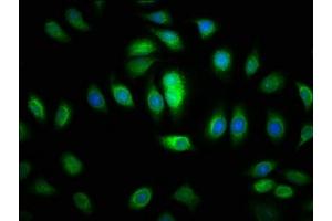 Immunofluorescence staining of A549 cells with ABIN7168566 at 1:200, counter-stained with DAPI.