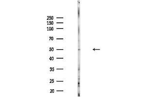 anti-SET and MYND Domain Containing 3 (SMYD3) (N-Term) antibody
