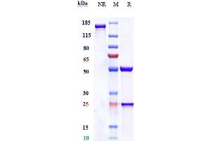 Anti-CEACAM5 / CEA / CD66e Reference Antibody (labetuzumab) on SDS-PAGE under reducing (R) condition. (Recombinant CEACAM5 (Labetuzumab Biosimilar) anticorps)