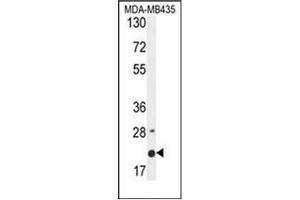 Western blot analysis of MS4A4A Antibody (N-term) in MDA-MB435 cell line lysates (35ug/lane). (MS4A4A anticorps  (N-Term))