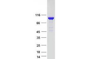 phosphorylase, Glycogen, Brain (GPBB) protein (Myc-DYKDDDDK Tag)