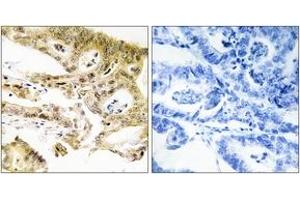 Immunohistochemistry (IHC) image for anti-Mediator Complex Subunit 23 (MED23) (AA 1-50) antibody (ABIN2889807) (MED23 anticorps  (AA 1-50))