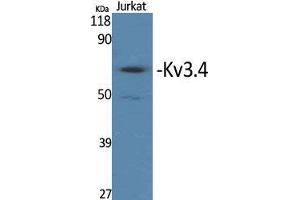 Western Blot (WB) analysis of specific cells using Kv3. (Kv3.4 anticorps  (Ser676))