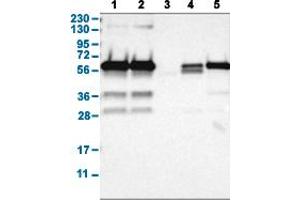 Western Blot analysis with HDAC2 polyclonal antibody . (HDAC2 anticorps  (AA 415-488))