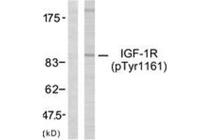 Western blot analysis of extracts from 293 cells treated with Insulin, using IGF1R (Phospho-Tyr1161) Antibody. (IGF1R anticorps  (pTyr1161))