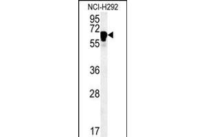 TTC26 Antibody (C-term) (ABIN651518 and ABIN2840274) western blot analysis in NCI- cell line lysates (35 μg/lane). (TTC26 anticorps  (C-Term))