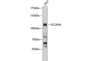 Western blot analysis of extracts of 293T cells, using SLC26 antibody (ABIN6129129, ABIN6147938, ABIN6147939 and ABIN6214535) at 1:1000 dilution. (SLC26A6 anticorps  (AA 509-758))