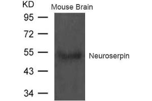 Western blot analysis of extract from Mouse brain tissue using Neuroserpin Antibody (Neuroserpin anticorps)