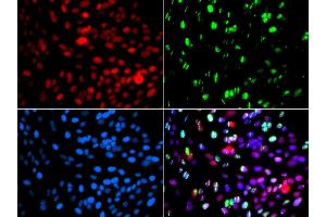 Immunofluorescence analysis of GFP-RNF168 transgenic U2OS cells using POLD3 antibody. (POLD3 anticorps  (AA 197-466))