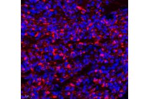 Immunofluorescence of paraffin embedded rat lung using MAL2 (ABIN7074549) at dilution of 1: 650 (400x lens)