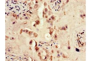 Immunohistochemistry of paraffin-embedded human placenta tissue using ABIN7167466 at dilution of 1:100 (ERBB4 anticorps  (AA 1027-1204))