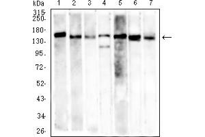 Western blot analysis using MSH6 mouse mAb against SH-SY5Y (1), K562 (2), Hela (3), PC-3 (4), HCT116 (5), HEK293 (6), and A549 (7) cell lysate.