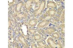 Immunohistochemistry of paraffin-embedded Rat kidney using Myelin Basic protein Polyclonal Antibody at dilution of 1:200 (40x lens).