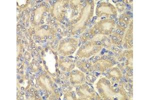 Immunohistochemistry of paraffin-embedded Rat kidney using Myelin Basic protein Polyclonal Antibody at dilution of 1:200 (40x lens). (MBP anticorps)