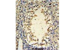 Immunohistochemistry (IHC) image for anti-IMP3, U3 Small Nucleolar Ribonucleoprotein (IMP3) antibody (ABIN3004369) (IMP3 anticorps)