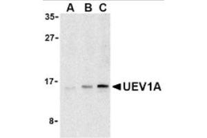 Image no. 1 for anti-Ubiquitin-Conjugating Enzyme E2 Variant 1 (UBE2V1) (C-Term) antibody (ABIN265158) (UBE2V1 anticorps  (C-Term))