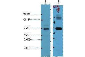 Western Blotting (WB) image for anti-alpha-Methylacyl-CoA Racemase (AMACR) antibody (ABIN3181117) (AMACR anticorps)