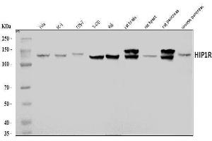 Western blot analysis of HIP1R using anti-HIP1R antibody (ABIN7601290).