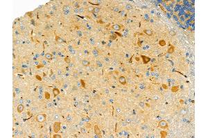 ABIN6258458 and ABIN6275750 at 1/100 staining Mouse brain tissue by IHC-P.
