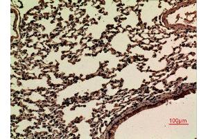 Immunohistochemistry (IHC) analysis of paraffin-embedded Mouse Lung, antibody was diluted at 1:100.