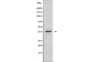 Western blot analysis of extracts from MCF-7 cells, using ABHD9 antibody. (ABHD9 anticorps  (N-Term))