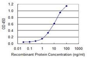 Detection limit for recombinant GST tagged IRX6 is 0. (IRX6 anticorps  (AA 337-446))