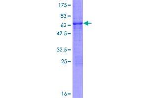 Image no. 1 for Polycomb Group Ring Finger 6 (PCGF6) (AA 1-277) protein (GST tag) (ABIN1314308)