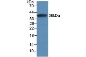 Detection of Recombinant SFRP1, Human using Monoclonal Antibody to Secreted Frizzled Related Protein 1 (SFRP1)