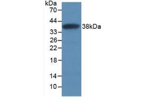 Detection of Recombinant SFRP1, Human using Monoclonal Antibody to Secreted Frizzled Related Protein 1 (SFRP1) (SFRP1 anticorps  (AA 32-314))