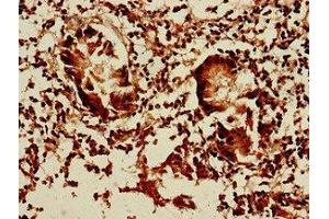 Immunohistochemistry of paraffin-embedded human appendix tissue using ABIN7150819 at dilution of 1:100
