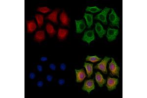 ABIN7094361 and ABIN7098408 staining HepG2 cells by IF/ICC.