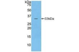 Detection of Recombinant PKN1, Human using Polyclonal Antibody to Protein Kinase N1 (PKN1) (PKN1 anticorps  (AA 615-874))