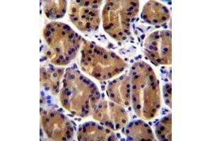 Immunohistochemistry analysis in formalin fixed and paraffin embedded human stomach tissue reacte with Plakophilin-2 Antibody (C-term) followed whcih was peroxidase conjugated to the secondary antibody and followed by DAB staining.