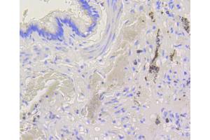 Immunohistochemistry of paraffin-embedded human lung using BAK1 antibody (ABIN4903006) at dilution of 1:100 (40x lens). (BAK1 anticorps)