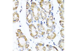 Immunohistochemistry of paraffin-embedded human stomach using ST6GAL1 antibody (ABIN5973377) at dilution of 1/100 (40x lens). (ST6GAL1 anticorps)