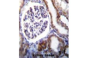 IFT88 Antibody (C-term) immunohistochemistry analysis in formalin fixed and paraffin embedded human kidney tissue followed by peroxidase conjugation of the secondary antibody and DAB staining. (IFT88 anticorps  (C-Term))