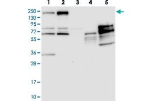 Western blot analysis of Lane 1: RT-4, Lane 2: U-251 MG, Lane 3: Human Plasma, Lane 4: Liver, Lane 5: Tonsil with PDS5B polyclonal antibody  at 1:250-1:500 dilution. (PDS5B anticorps)