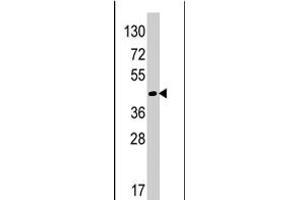 Western blot analysis of RAD9A polyclonal antibody  in HeLa cell line lysates (35 ug/lane). (RAD9A anticorps  (Internal Region))
