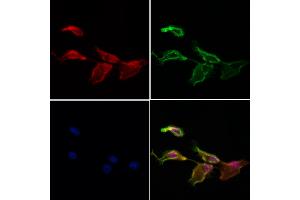 ABIN7094098 and ABIN7098142 staining Hela cells by IF/ICC. (C14orf102 anticorps  (Internal Region))