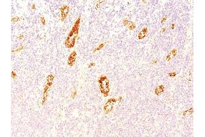 Formalin-fixed, paraffin-embedded human Pancreas stained with vWF Mouse Monoclonal Antibody (3E2D10).