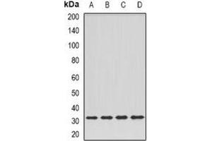 Western blot analysis of DPM1 expression in Hela (A), SKOV3 (B), mouse kidney (C), rat liver (D) whole cell lysates.