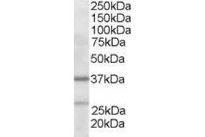 ABIN184750 staining (2µg/ml) of Human Liver lysate (RIPA buffer, 35µg total protein per lane). (ARPC1B anticorps  (N-Term))
