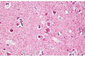 Anti-RPS6KA5 / MSK1 antibody IHC staining of human brain, cortex neurons. (MSK1 anticorps  (AA 551-600))