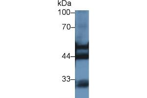 Western blot analysis of Rat Kidney lysate, using Rat KRT7 Antibody (1 µg/ml) and HRP-conjugated Goat Anti-Rabbit antibody ( (Cytokeratin 7 anticorps  (AA 255-393))