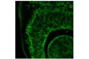 Itgb1 antibody used at a dilution of 1:500 to detect human eye (day 24).