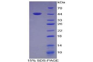 SDS-PAGE (SDS) image for Angiogenin (ANG) (AA 25-145) protein (His tag,GST tag) (ABIN2122397) (ANG Protein (AA 25-145) (His tag,GST tag))