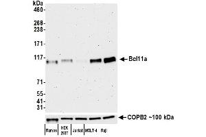 Western Blotting (WB) image for anti-B-Cell CLL/lymphoma 11A (Zinc Finger Protein) (BCL11A) (AA 785-835) antibody (ABIN7452847) (Recombinant BCL11A anticorps  (AA 785-835))