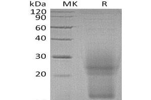 Western Blotting (WB) image for Interleukin 3 (IL-3) protein (His tag) (ABIN7320592) (IL-3 Protein (His tag))
