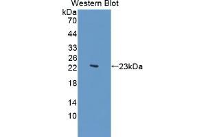 Detection of Recombinant KDM4A, Human using Polyclonal Antibody to Lysine Specific Demethylase 4A (KDM4A) (KDM4A anticorps  (AA 141-310))