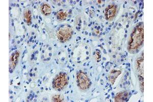 Immunohistochemical staining of paraffin-embedded Human Kidney tissue using anti-DOK7 mouse monoclonal antibody. (DOK7 anticorps)